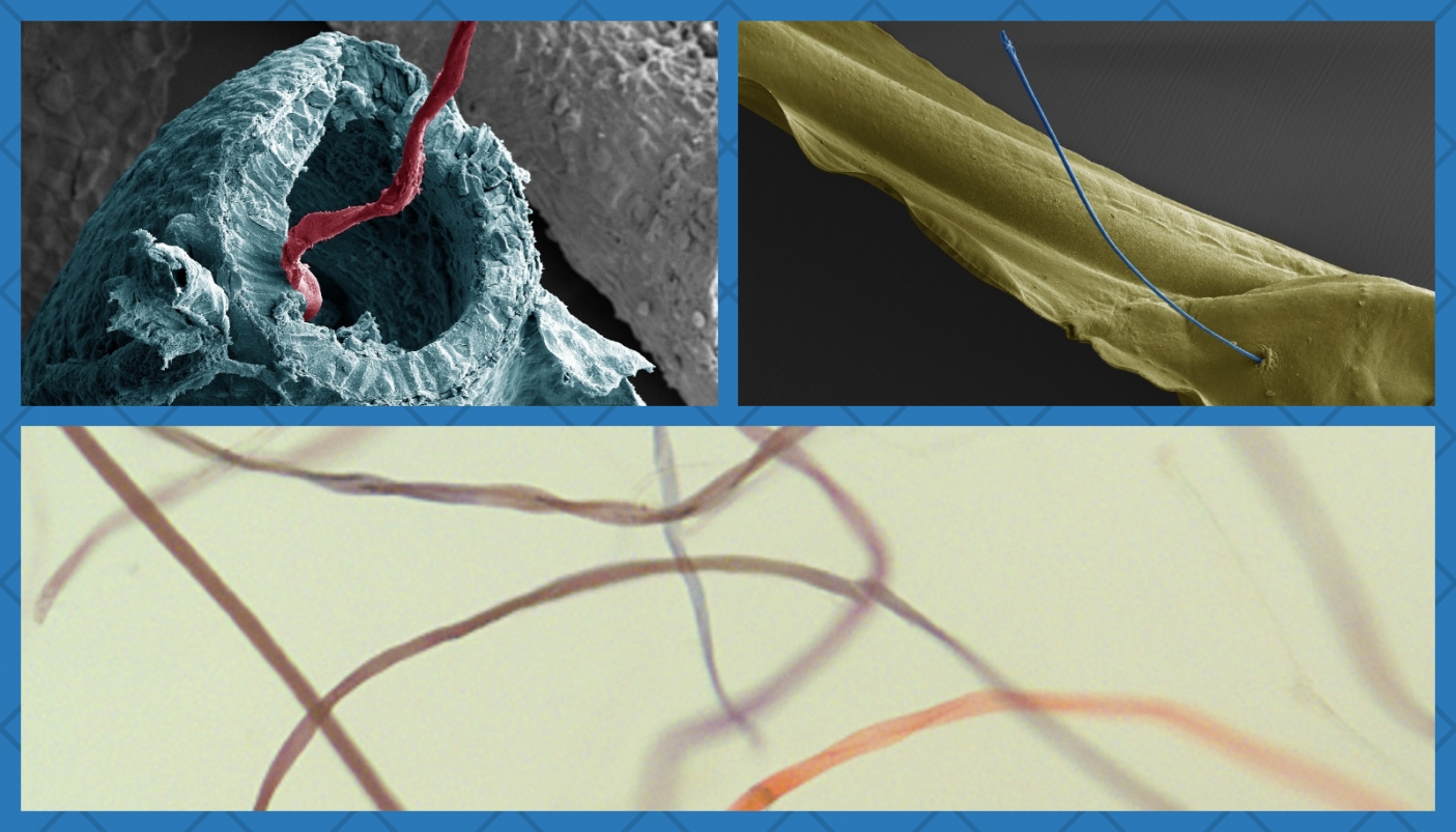 Nelle foto, in senso orario: un intestino di Xenopous aperto con una fibra che esce; larva della rana (Xenopous laevis) trafitta da una fibra di poliestere prese al microscopio elettronico a scansione, Università degli Studi di Milano