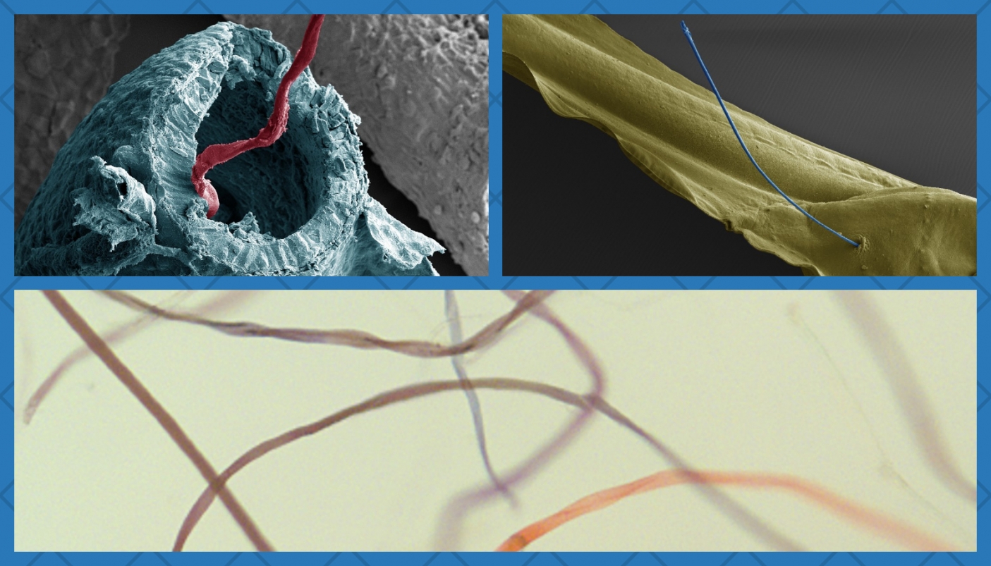  Nelle foto, in senso orario: un intestino di Xenopous aperto con una fibra che esce; larva della rana (Xenopous laevis) trafitta da una fibra di poliestere prese al microscopio elettronico a scansione, Universit&agrave; degli Studi di Milano